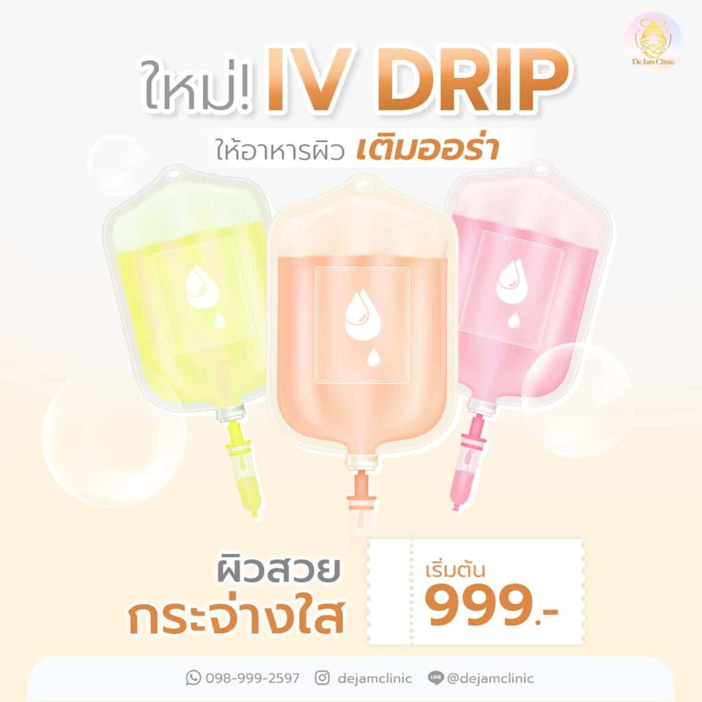 iv drip คือ