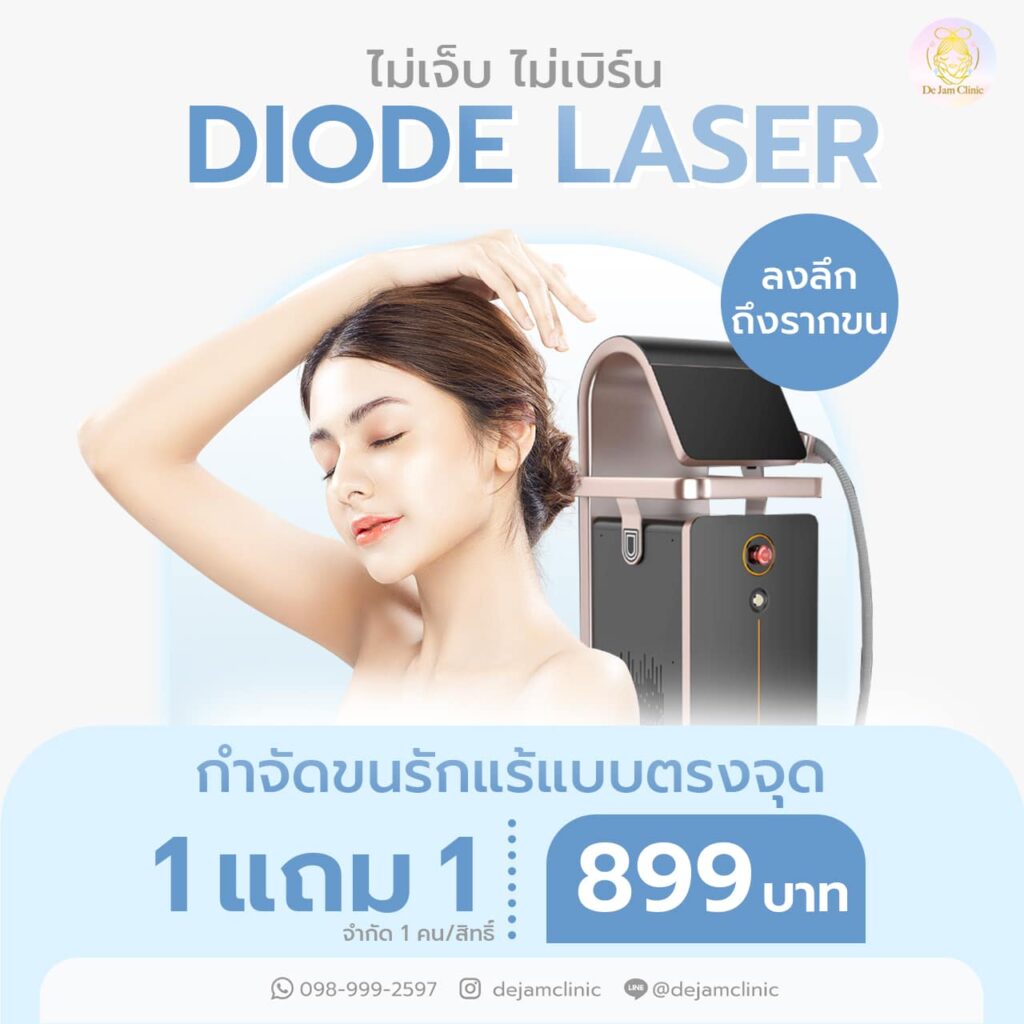 เลเซอร์ กำจัดขน