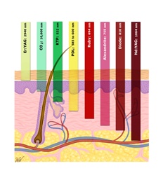 เลเซอร์ กำจัดขน