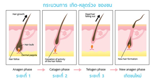 เลเซอร์ขนรักแร้ เชียงใหม่