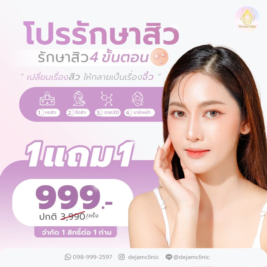 หมอสิว เชียงใหม่