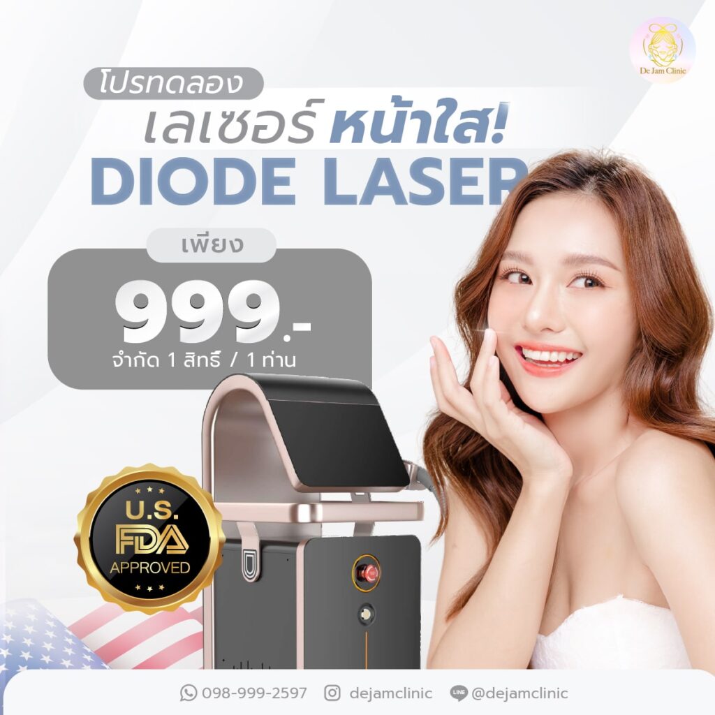 เลเซอร์ฝ้า กระ เชียงใหม่