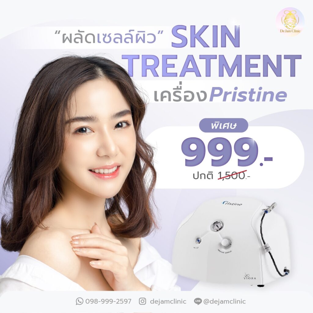 ทรีทเม้นท์ เชียงใหม่